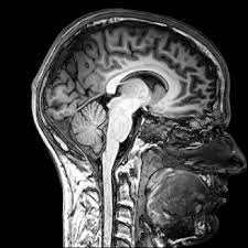 brain